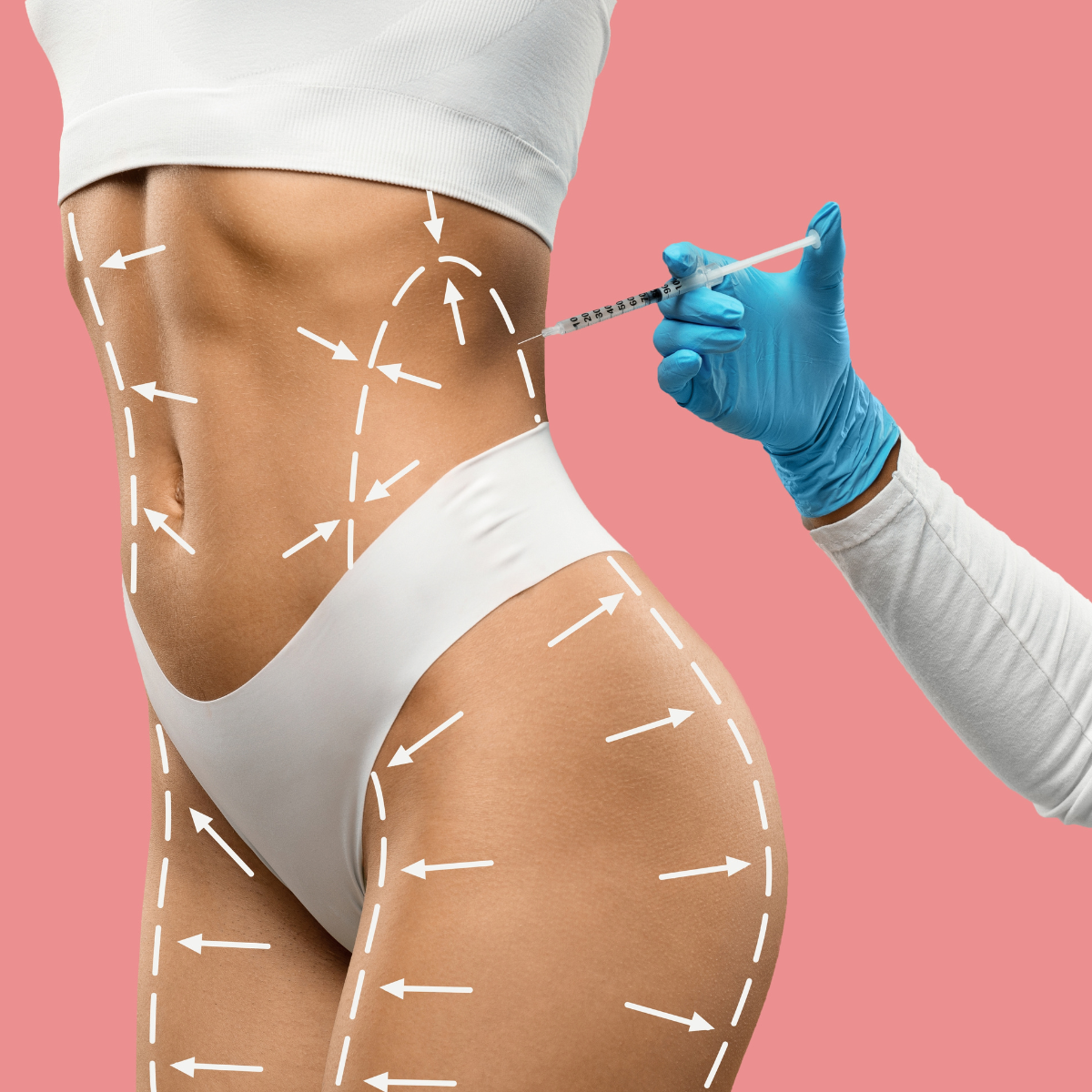 Body Sculpting with Fillers