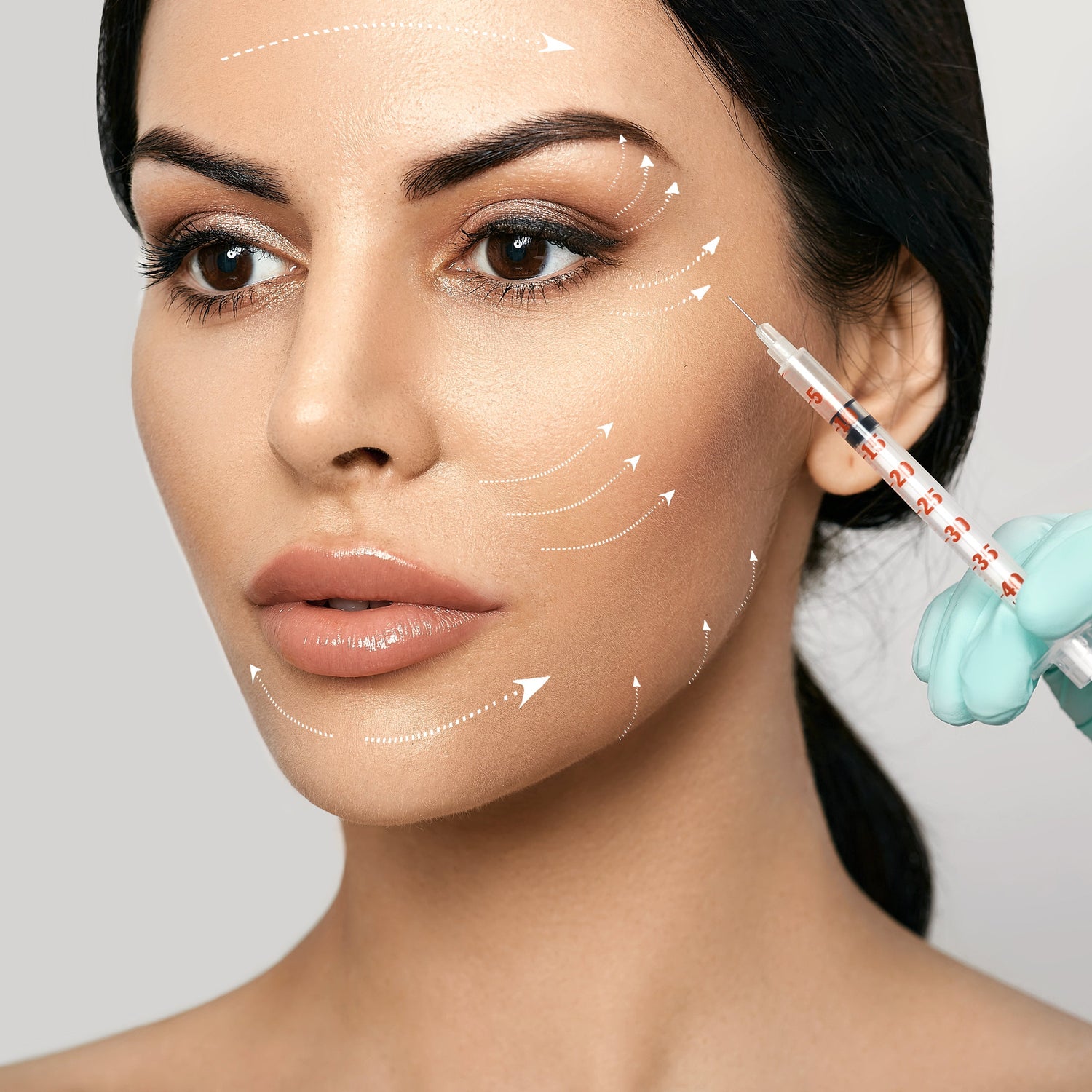 Top Areas for Facial Fillers: Contouring and Enhancement